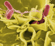 Salmonella bacteria is a common cause of foodborne illness, particularly in undercooked chicken and chicken eggs