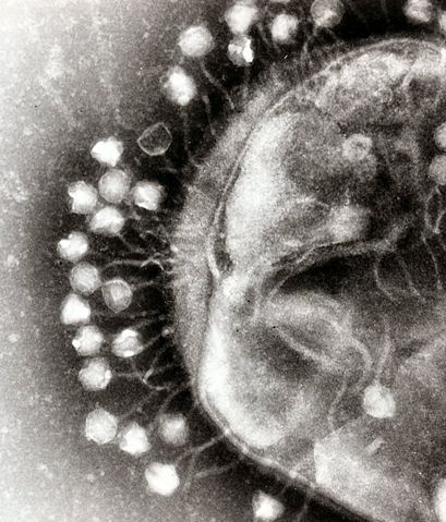 Image:Phage.jpg