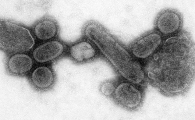 Image:Reconstructed Spanish Flu Virus.jpg