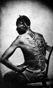 Slaves – like this man, photographed in 1863 – endured harsh treatment and brutal whipping.
