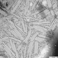 Tobacco mosaic virus