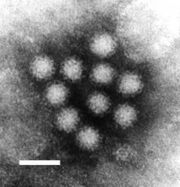 Norovirus. Ten Norovirus particles; this RNA virus causes winter vomiting disease. It is often in the news as a cause of gastro-enteritis on cruise ships and in hospitals.