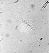 Triactinomyxon stage of Myxobolus cerebralis. Note the three "tails".