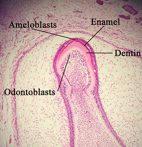 Image:Enamelmineralization11-17-05.jpg