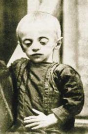 Child victim of the Holodomor famine