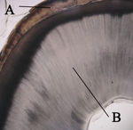 Histologic slide of tooth. Note the tubular appearance of dentin. A: enamel B: dentin