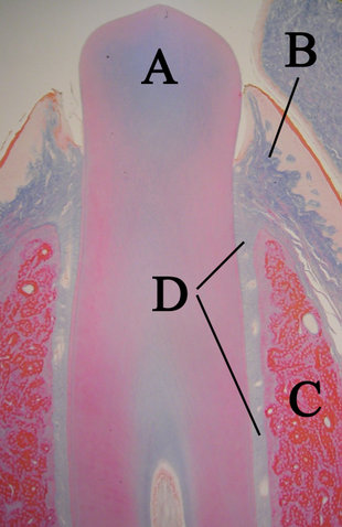 Image:Eruptingtoothwithlabels11-24-05.jpg