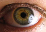 The human eyeThe pupil is the central transparent area (showing as black). The greenish-brown area surrounding it is the iris. The white outer area is the sclera, the central transparent part of which is the cornea.