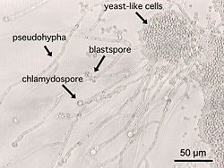 A photomicrograph of Candida albicans showing hyphal outgrowth and other morphological characteristics.