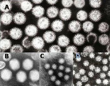 Gastroenteritis viruses: A = rotavirus, B = adenovirus, C = Norovirus and D = Astrovirus. The virus particles are shown at the same magnification to allow size comparison.