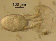 A nauplius of Euphausia pacifica hatching, emerging backwards from the egg