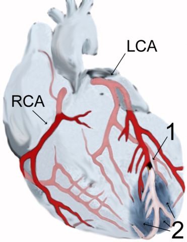 Image:AMI scheme.png