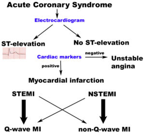 Classification of acute coronary syndromes.