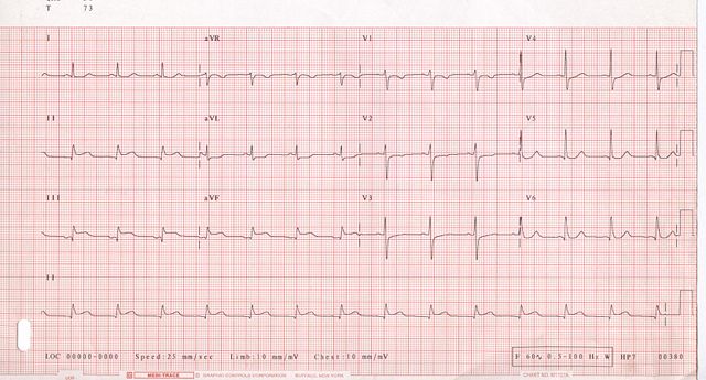 Image:ECG 001.jpg