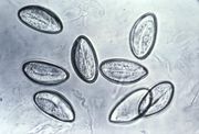 Pinworm eggs are easily seen under the microscope.