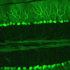 Figure 6: Confocal micrograph from mouse cerebellum expressing green-fluorescent protein in Purkinje cells.