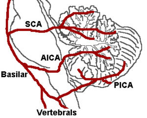 Figure 7: The three major arteries of the cerebellum: the SCA, AICA, and PICA.