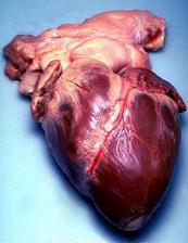 Human heart removed from a 64-year-old male.