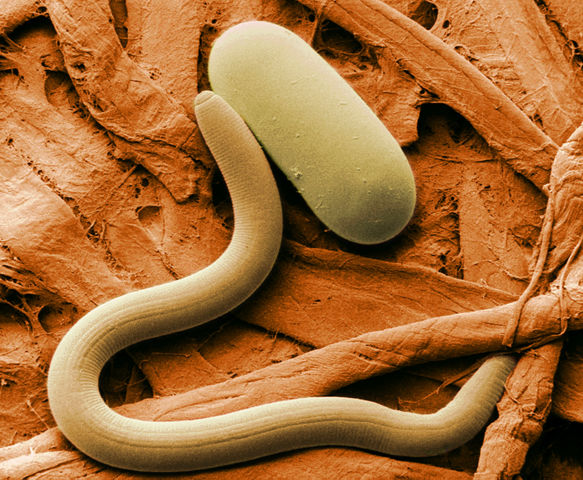 Image:Soybean cyst nematode and egg SEM.jpg