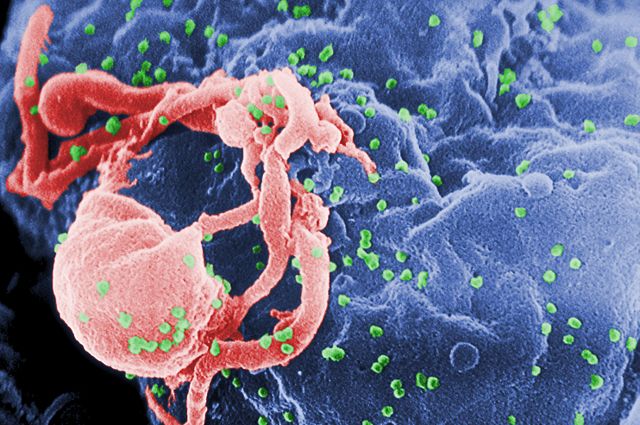 Image:HIV-budding-Color.jpg