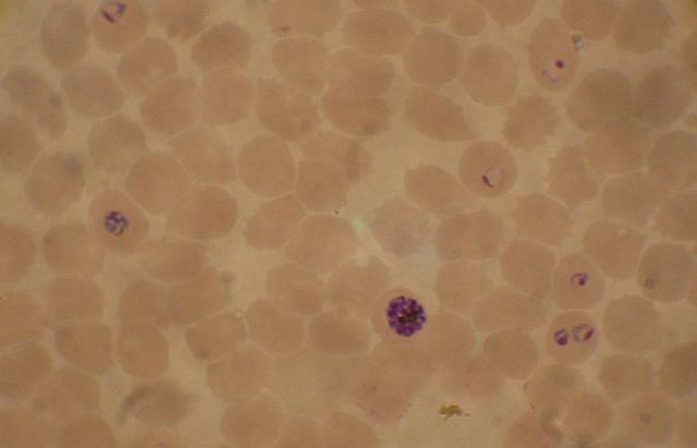 Image:Plasmodium falciparum 02.jpg