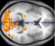 Functional magnetic resonance imaging provides some evidence for the underconnectivity theory of autism.