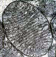 Electron micrograph of a mitochondrion showing its mitochondrial matrix and membranes