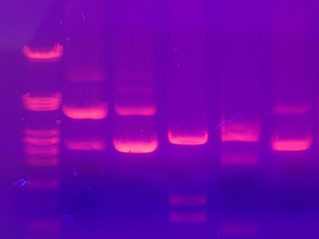 Image:Gel electrophoresis 2.jpg