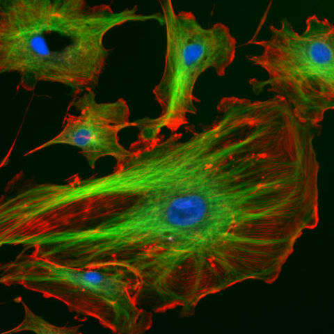 Image:FluorescentCells.jpg