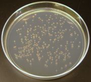 E coli colonies on a plate of agar, an example of cellular cloning and often used in molecular cloning.