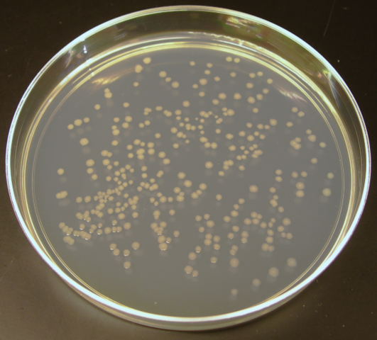 Image:Ecoli colonies.png