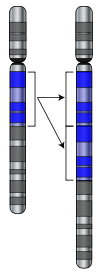 Duplication of part of a chromosome