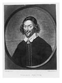 William Prynne (1600-1669), Puritan politician who opposed the policies of William Laud, Archbishop of Canterbury, and had his ears cut off as a result...