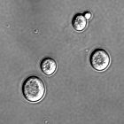 Sacharomyces cerevisiae cells in DIC microscopy.