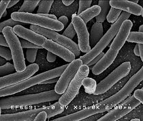 Escherichia coli image is 8 micrometres wide.
