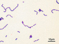 Streptococcus mutans visualized with a Gram stain
