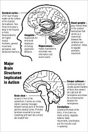 Autism affects many parts of the brain.
