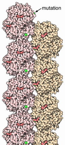 Image:Sickle cell hemoglobin.png