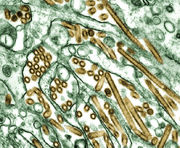 The A H5N1 virus, which causes Avian influenza