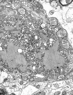 Micrograph with numerous rabies virions (small dark-grey rod-like particles) and Negri bodies, larger pathognomonic cellular inclusions of rabies infection