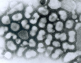 Influenza A virus, the virus that causes Avian flu. Transmission electron micrograph of negatively stained virus particles in late passage. (Source: Dr. Erskine Palmer, Centers for Disease Control and Prevention Public Health Image Library)