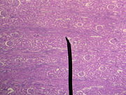 Microscopic photograph of the renal cortex.