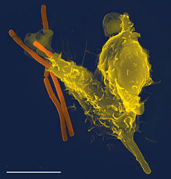 A scanning electron microscope image of a single neutrophil (yellow), engulfing anthrax bacteria (orange).