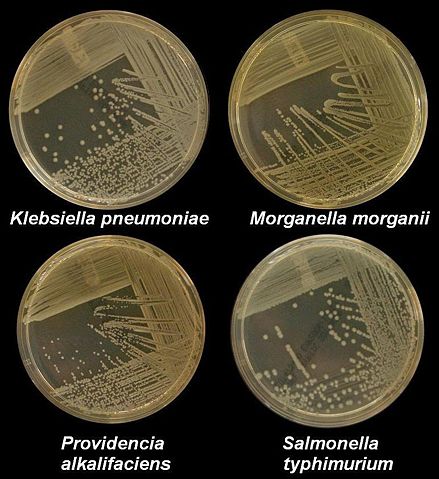 Image:K pneumoniae M morganii providencia styphimuriuma.JPG