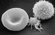 A scanning electron microscope (SEM) image of a normal red blood cell, a platelet, and a white blood cell.