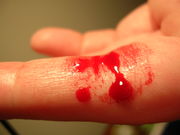 Blood from a finger