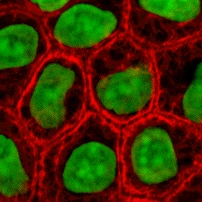 Cells in culture, stained for keratin (red) and DNA (green)
