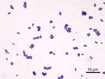 Gram stain of S. aureus.