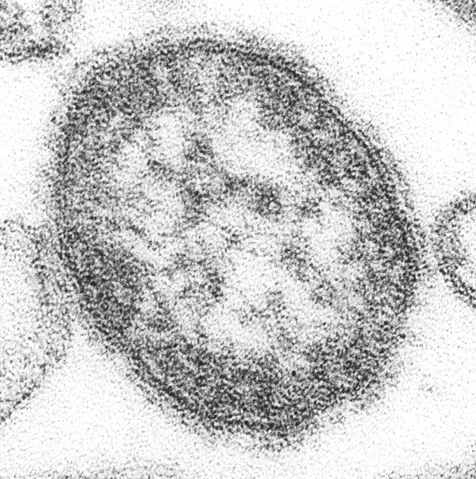 Image:Measles virus.JPG