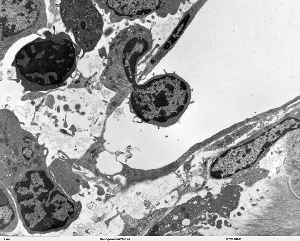 Image:Blood cell crossing vascular sinus wall - TEM.jpg